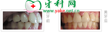 <a href='http://m.yadashi.com/Search/news.asp?Keywords=%C8%AB%B4%C9%D1%C0' >ȫ</a>