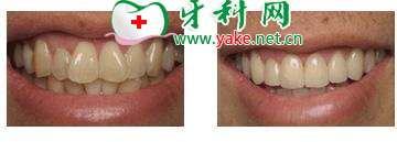 <a href='http://m.yadashi.com/Search/news.asp?Keywords=%BF%BE%B4%C9%D1%C0%D0%DE%B8%B4' >޸</a>