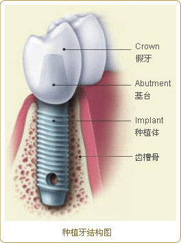 <a href='http://m.yadashi.com/Search/news.asp?Keywords=%D6%D6%D6%B2%D1%C0' >ֲ</a>